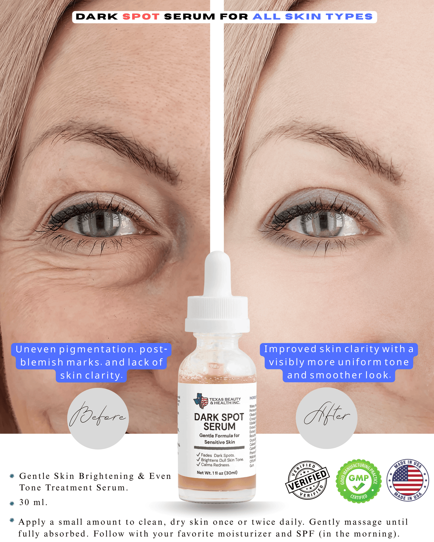 Dark Spot Serum for Sensitive Skin | Gentle Skin Brightening & Even Tone Treatment Serum